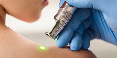 Laser in der Medizin